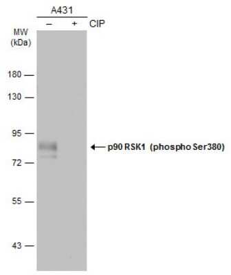 Western Blot: RSK1 [p Ser380] Antibody [NBP3-13243] - Untreated (-) and treated (+) A431 whole cell extracts (30 ug) were separated by 7.5% SDS-PAGE, and the membrane was blotted with RSK1 (phospho Ser380) antibody (NBP3-13243) diluted at 1:500. The HRP-conjugated anti-rabbit IgG antibody (NBP2-19301) was used to detect the primary antibody.